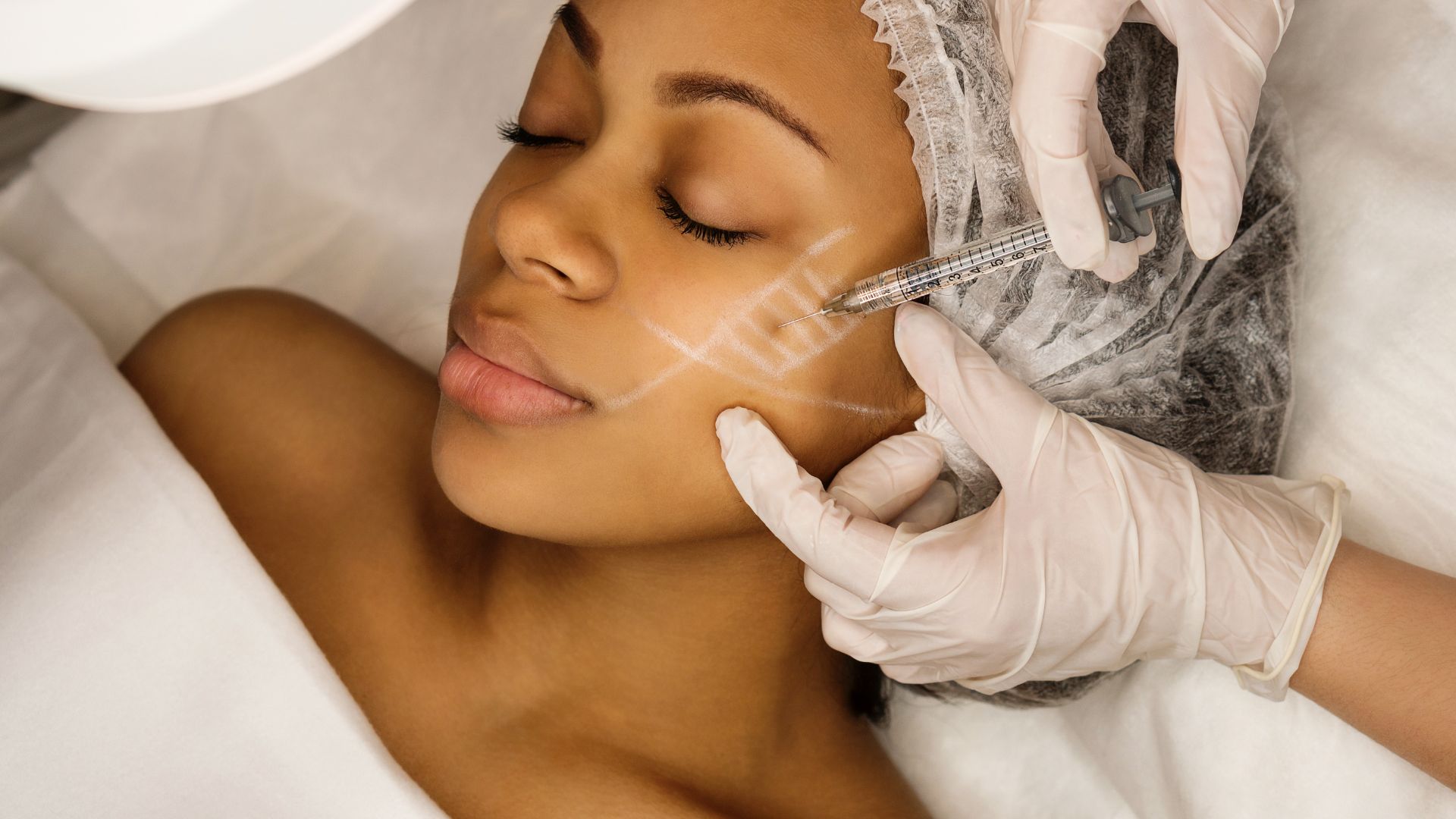 Aesthetic corrective treatments. Filler injections