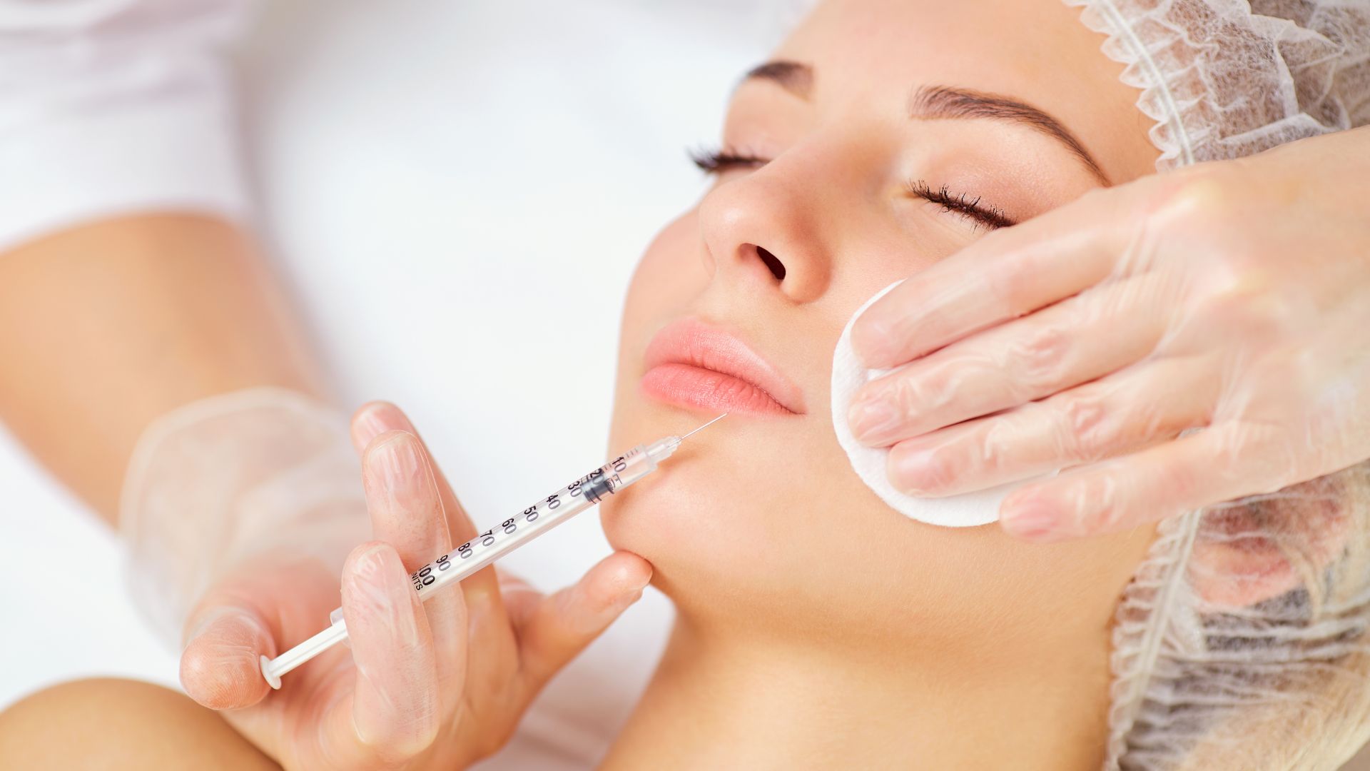 A Woman Getting Lip Fillers. Lip Filler Techniques