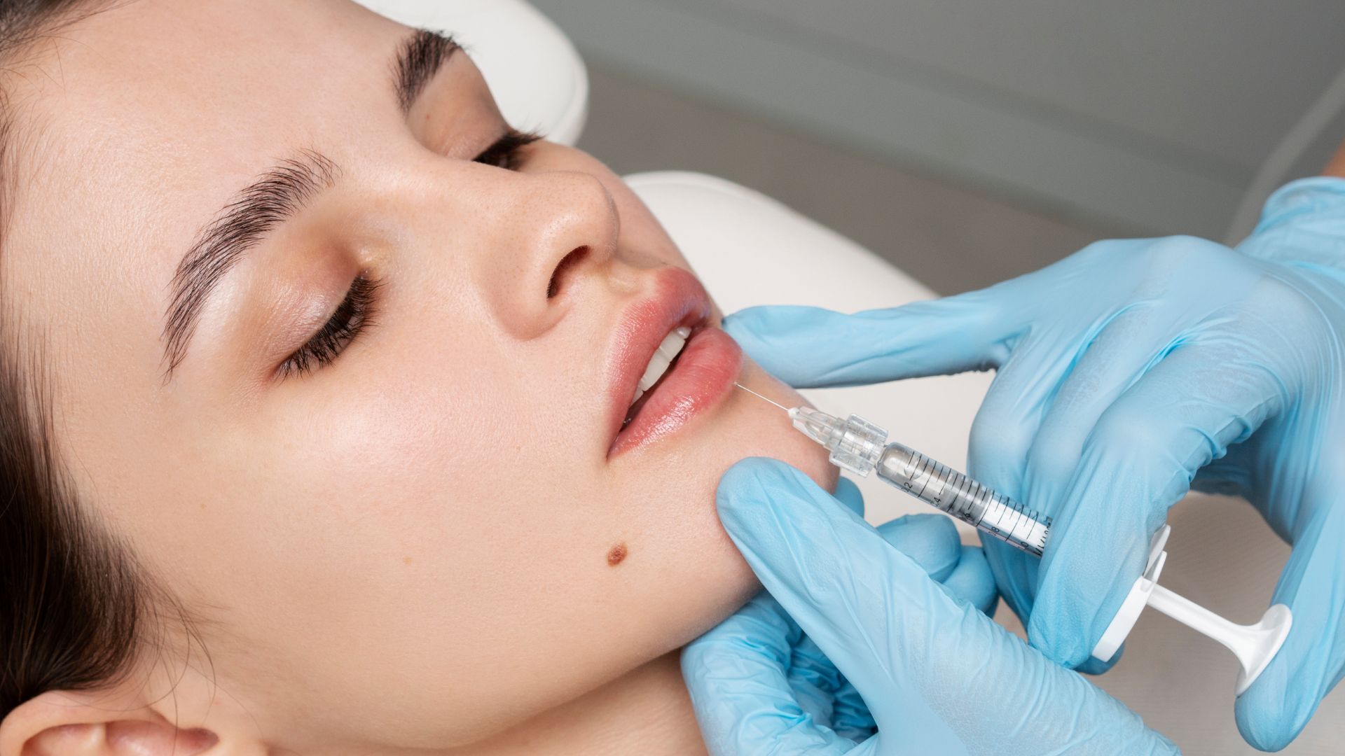 woman getting lip filler. Lip Filler Techniques