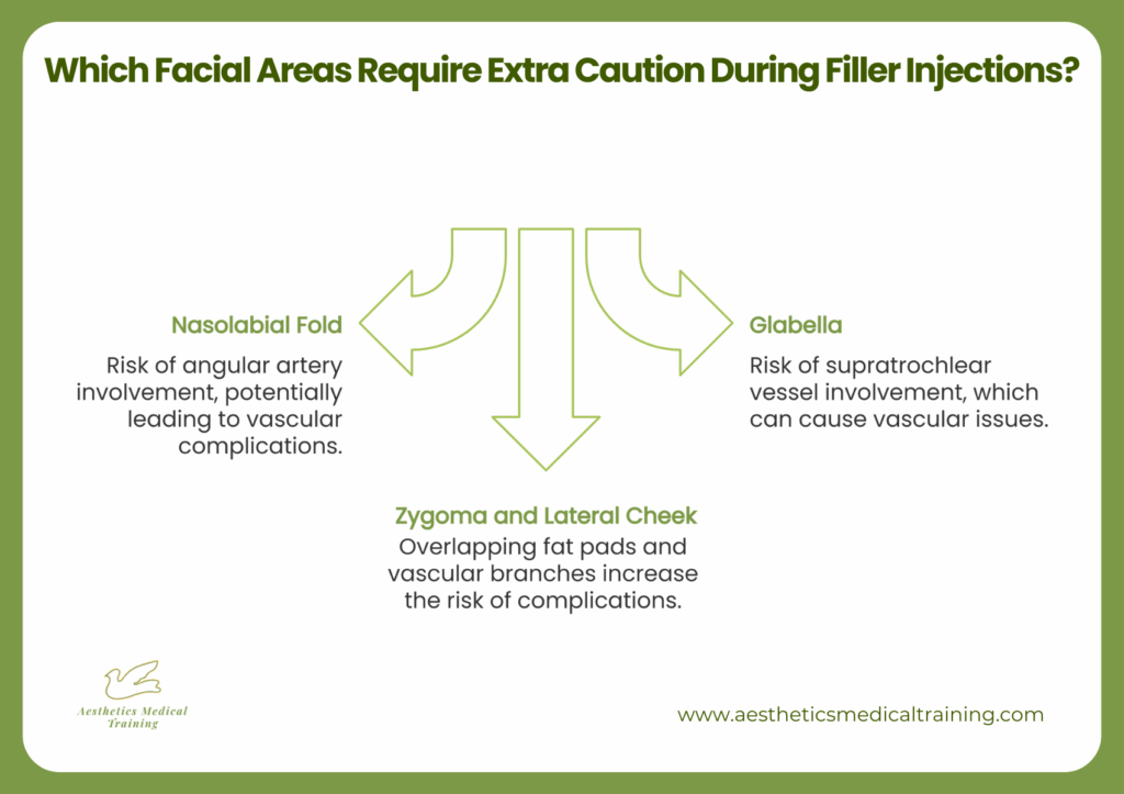 Infographic detailing **facial areas requiring caution during filler injections**: Nasolabial Fold (angular artery risk), Glabella (supratrochlear vessel risk), and Zygoma and Lateral Cheek (overlapping fat pads and vascular branches).